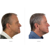 Foligain Triple Action Complete Formula For Thinning Hair For Men - 59 ml